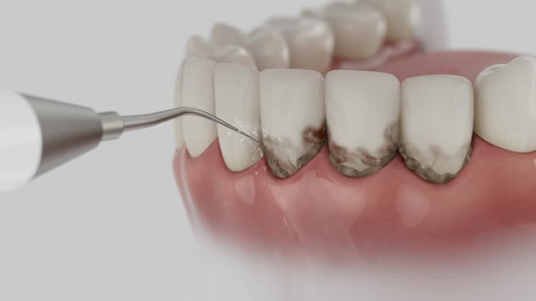 Trusted Root Canal Treatment service in Drexel, NC - Dentist Open Now